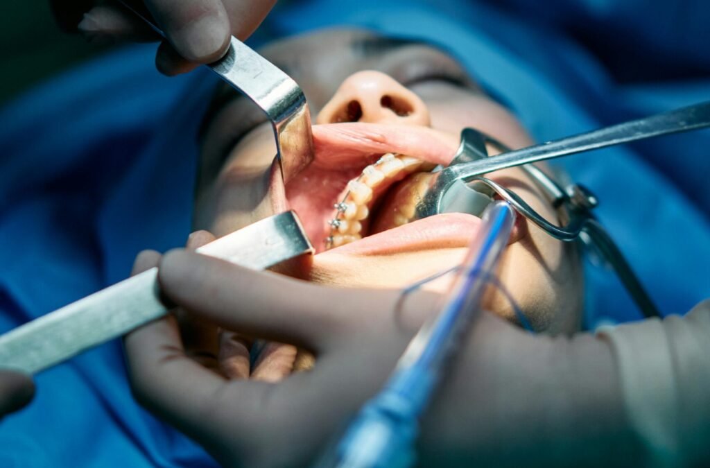 Close-up of dental surgery with medical professionals performing a procedure.